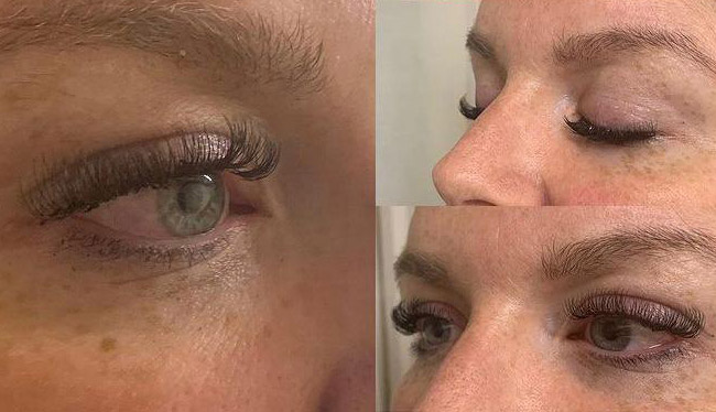 Httc Nottingham, Ilkeston - Eye treatments